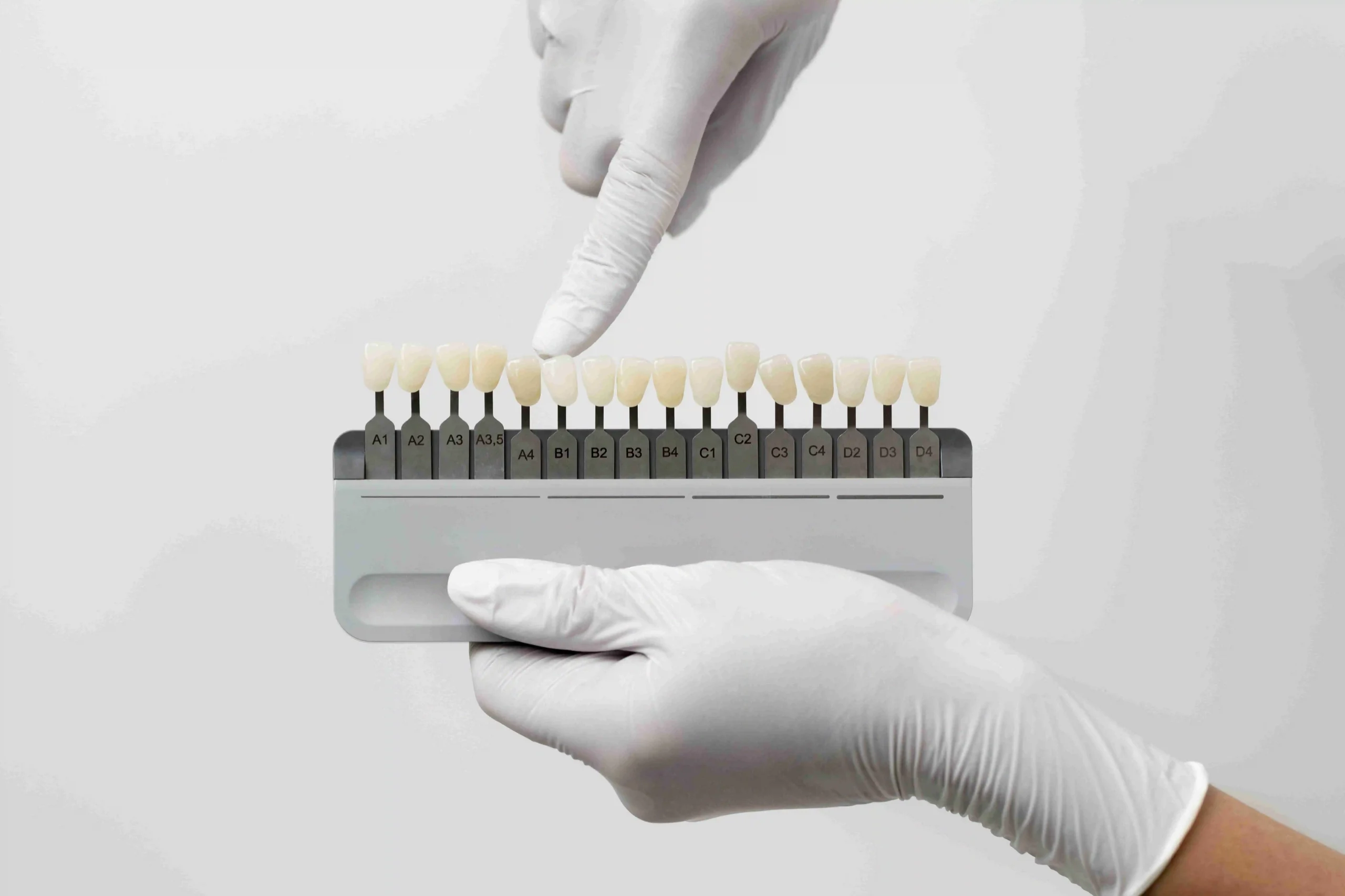 dental veneers treatment in baniyas