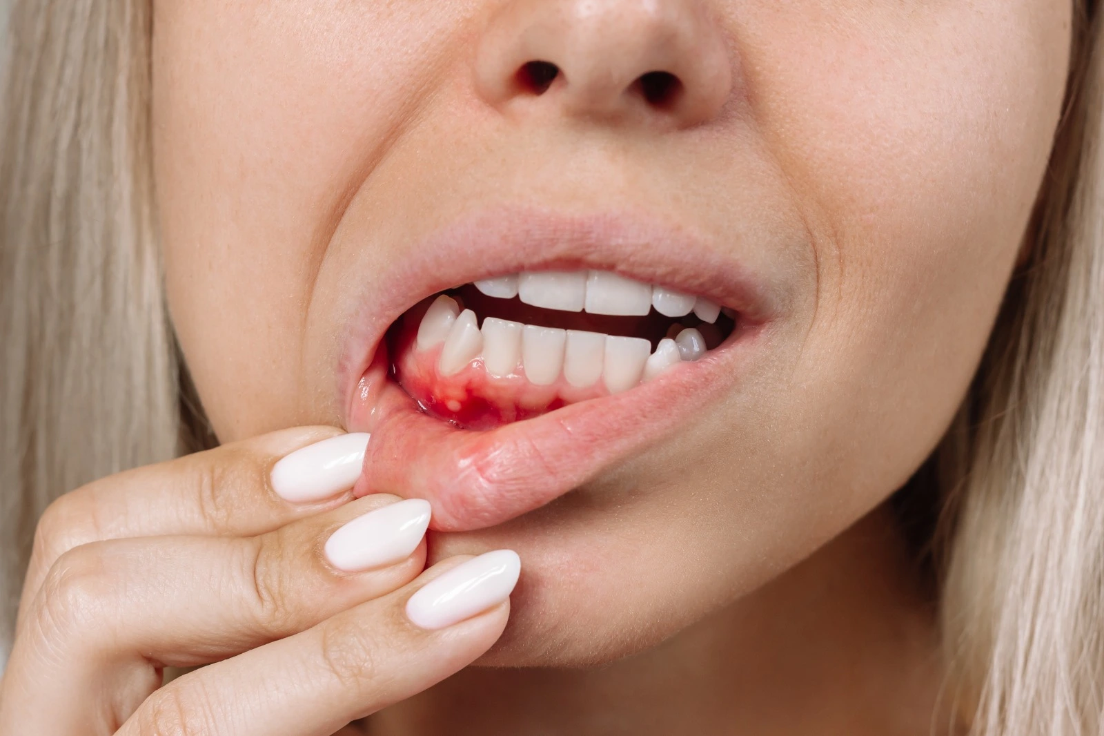 Periodontal Treatment Options in Baniyas