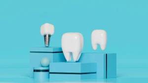 how long do dental implants last