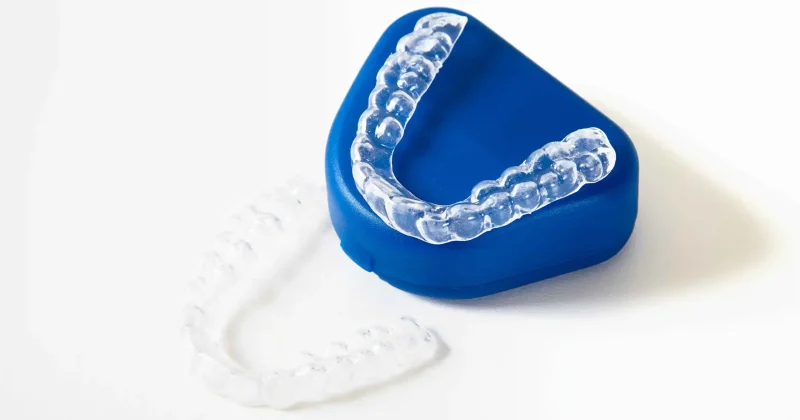 Invisalign treatment