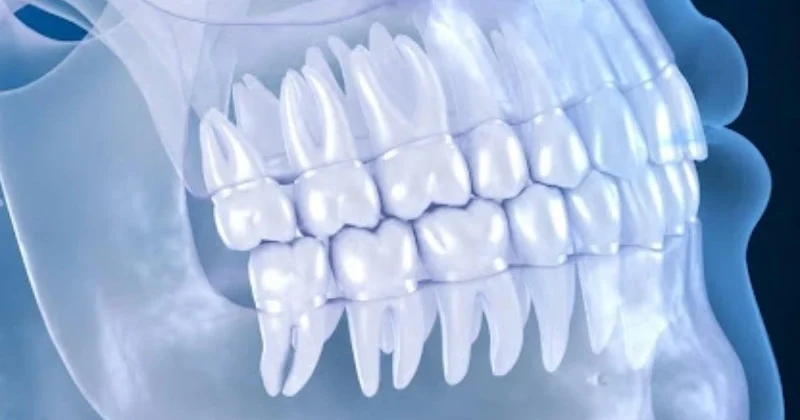 CBCT X-Ray in Baniyas