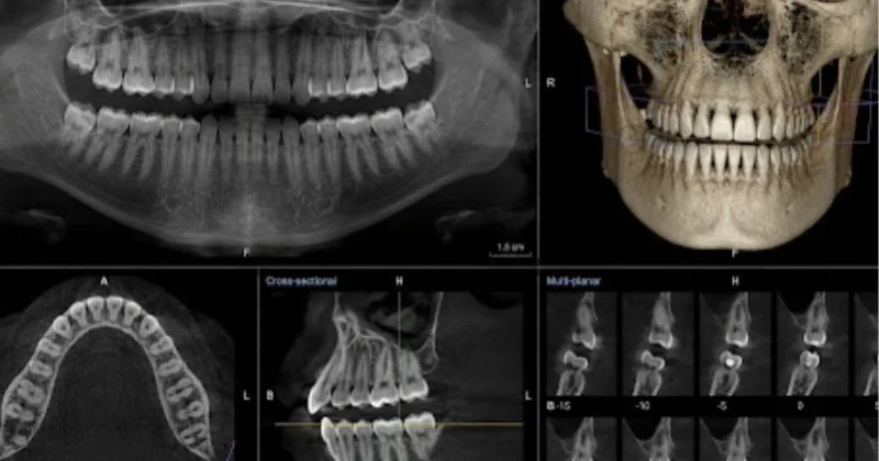 CBCT xray in baniyas, abudhabi