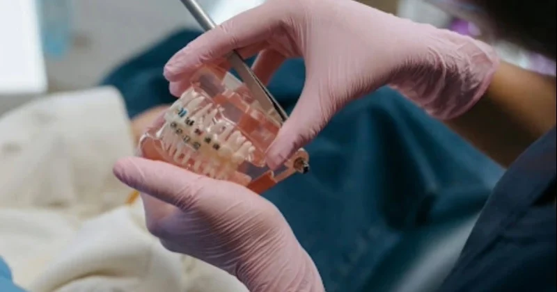 Dental braces treatment in Baniyas medical clinic