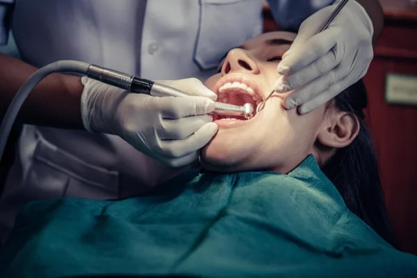 PERIODONTAL TREaTMENT IN BANIYAS