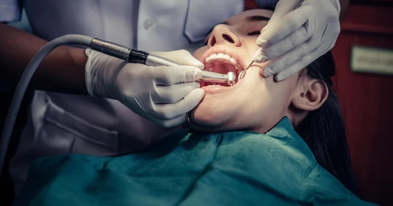 PERIODONTAL TREaTMENT IN BANIYAS